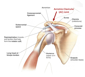 Shoulder acromioclavicular joint injuries common in athletes